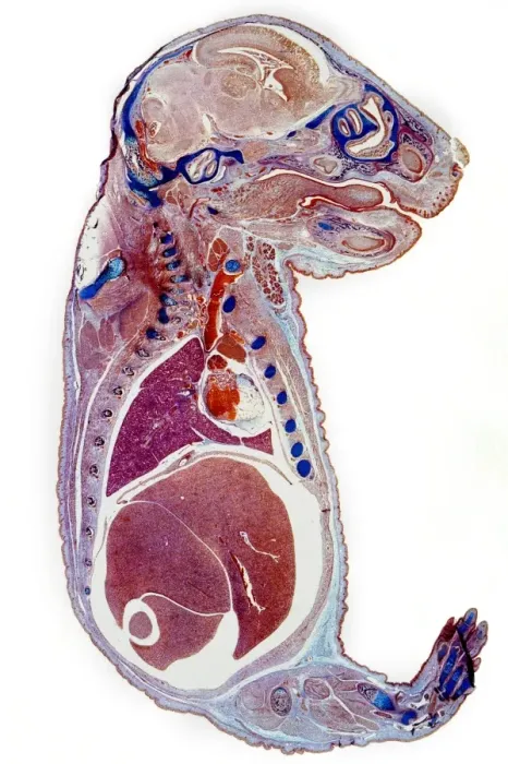 Framed Print : Section through a rat embryo Print Framed Print : Section through a rat embryo Print