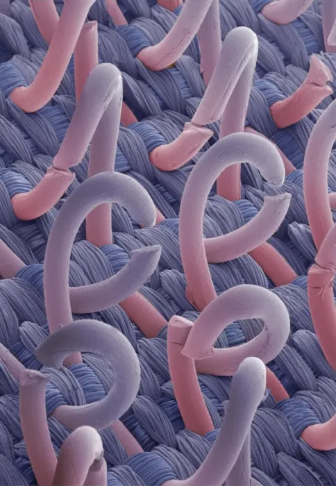 Framed Print : SEM Print of a Hook Fastener