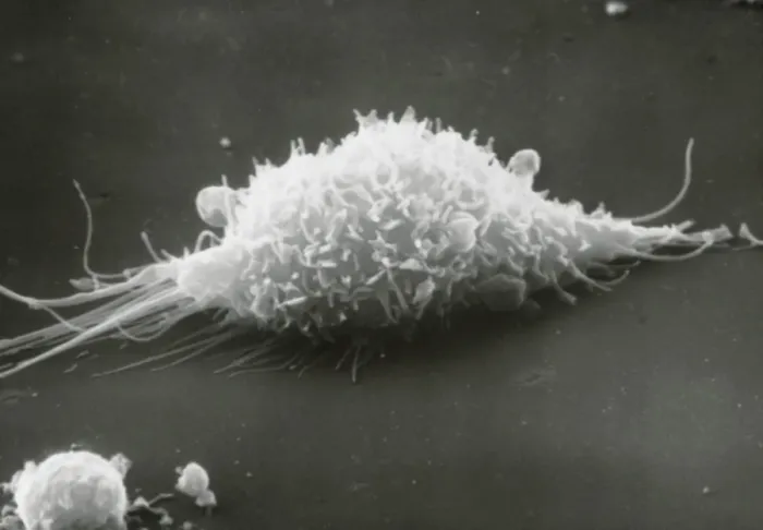 Framed Print : SEM Print of a macrophage cell in active movement over a surface Framed Print : SEM Print of a macrophage cell in active movement over a surface