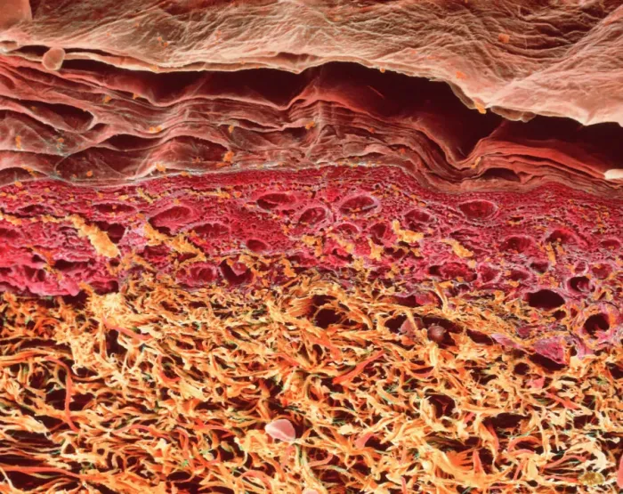 Framed Print : SEM Print of Human Skin Section Framed Print : SEM Print of Human Skin Section