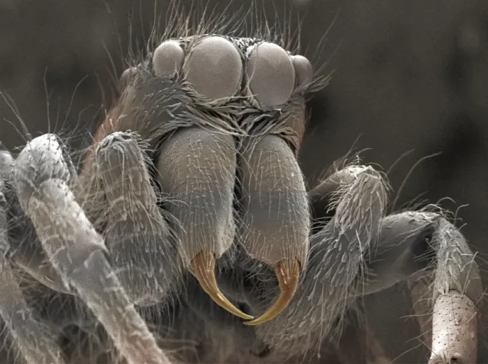 Framed Print : SEM Print of Zebra Jumping Spider Head Framed Print : SEM Print of Zebra Jumping Spider Head