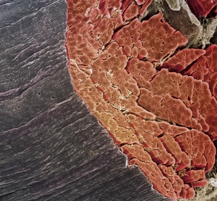 Framed Print : Skeletal Muscle Print, SEM Framed Print : Skeletal Muscle Print, SEM