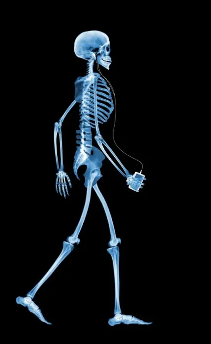 Framed Print : X-ray Skeleton Walking Print Framed Print : X-ray Skeleton Walking Print
