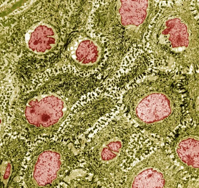 Framed Print : TEM Print of Skin Cells Framed Print : TEM Print of Skin Cells
