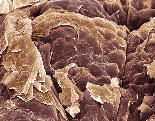 Skin, SEM. Skin. Coloured scanning electron micrograph 