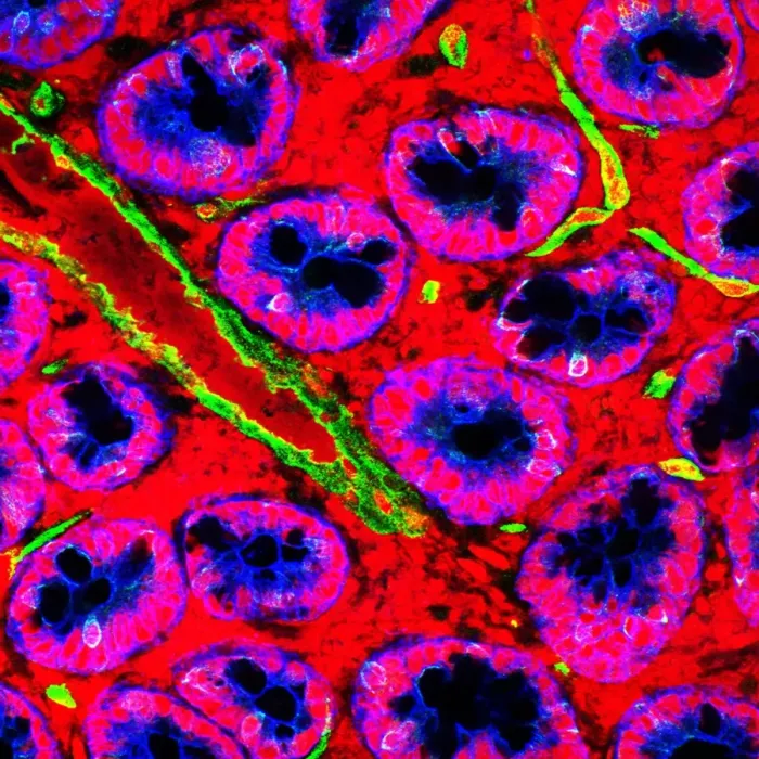 Framed Print : Small Intestine Print: Fluorescence Confocal Micrograph Framed Print : Small Intestine Print: Fluorescence Confocal Micrograph