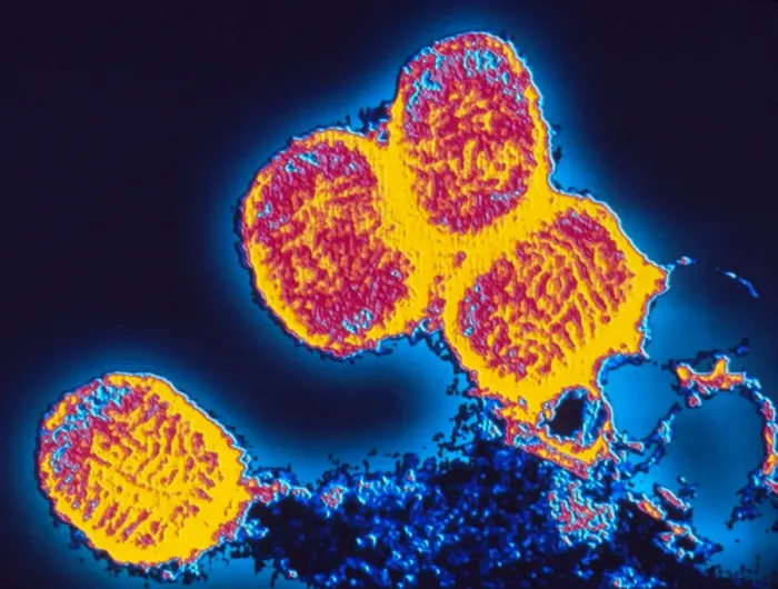 Framed Print : Smallpox virus coloured TEM print Framed Print : Smallpox virus coloured TEM print