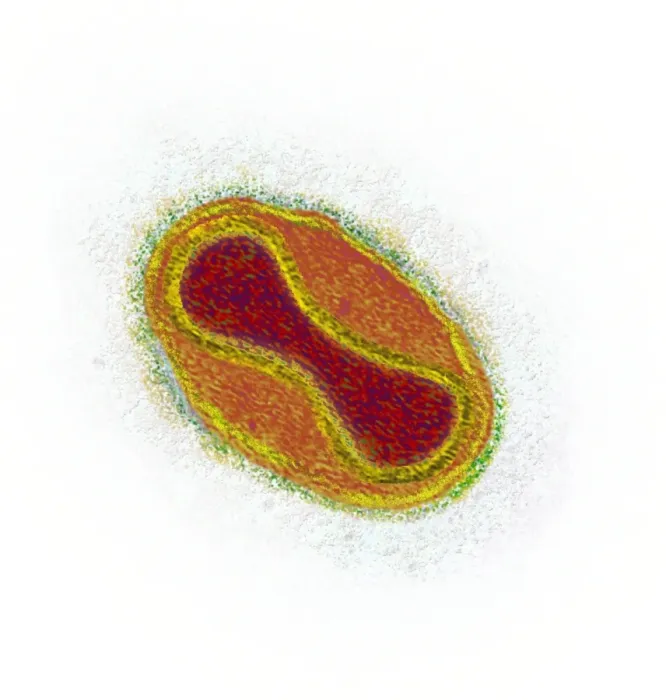 Framed Print : Smallpox virus particle print, TEM image Framed Print : Smallpox virus particle print, TEM image