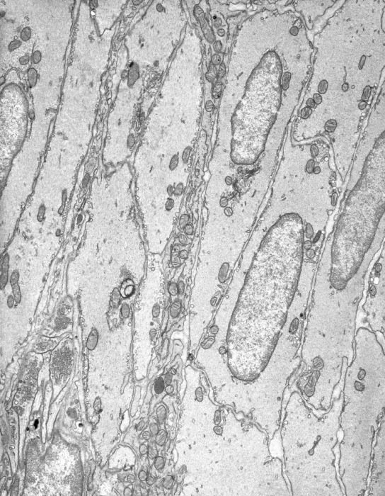 Framed Print : Smooth muscle tissue Print, TEM image of longitudinal section Framed Print : Smooth muscle tissue Print, TEM image of longitudinal section