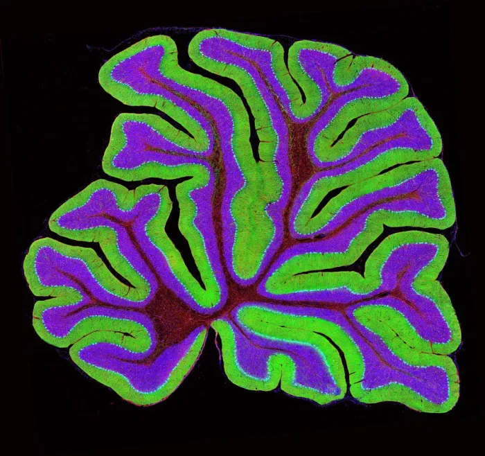 Framed Print : Cerebellum Structure Print, x20 Magnification Framed Print : Cerebellum Structure Print, x20 Magnification