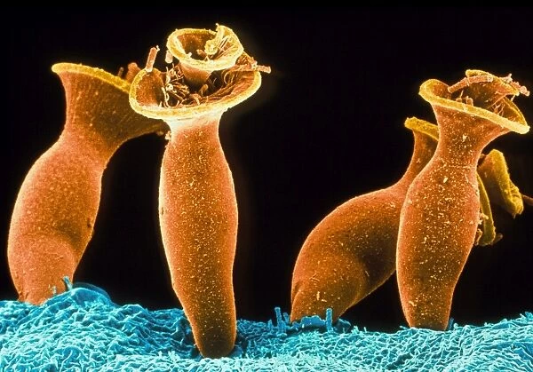 Spirochona protozoa