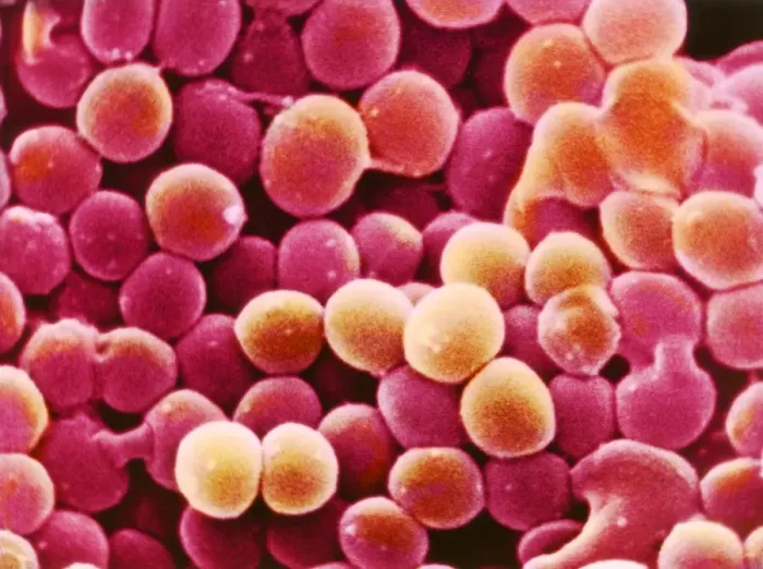 Framed Print : Coloured Scanning Electron Micrograph Print of Staphylococcus aureus Bacteria Framed Print : Coloured Scanning Electron Micrograph Print of Staphylococcus aureus Bacteria