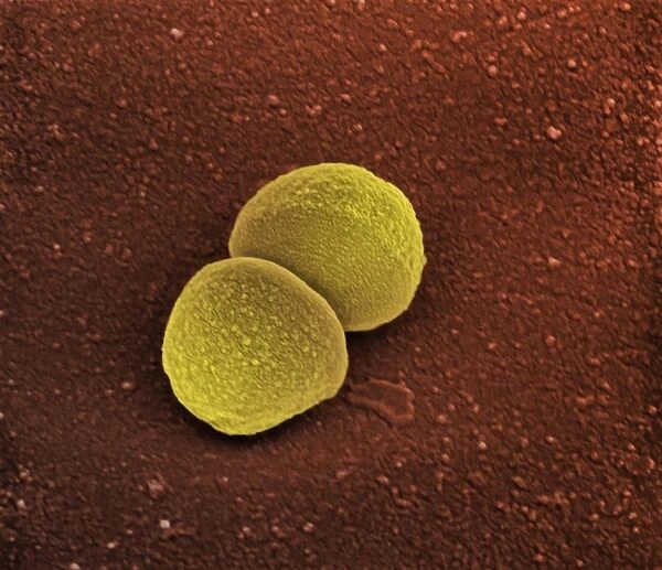 Staphylococcus aureus bacteria, SEM C013  /  4770
