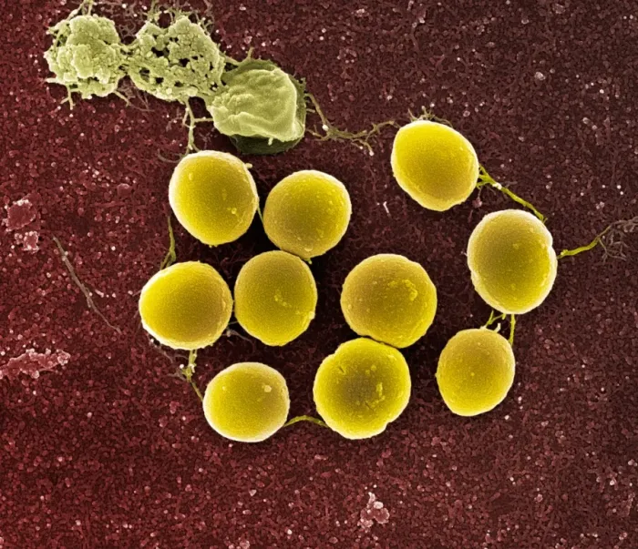 Framed Print : SEM Print of Staphylococcus aureus bacteria Framed Print : SEM Print of Staphylococcus aureus bacteria