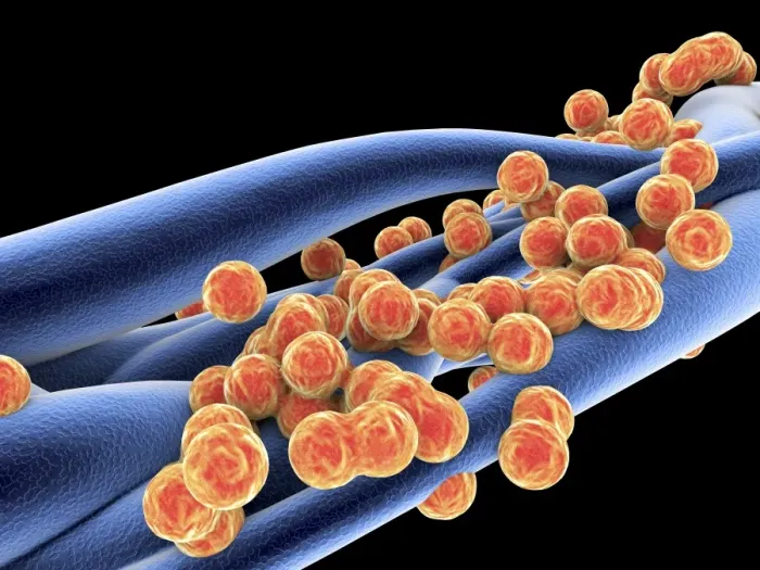 Framed Print : MRSA Bacteria Print Framed Print : MRSA Bacteria Print
