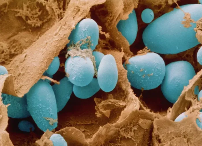 Framed Print : Coloured scanning electron micrograph of potato starch grains Framed Print : Coloured scanning electron micrograph of potato starch grains