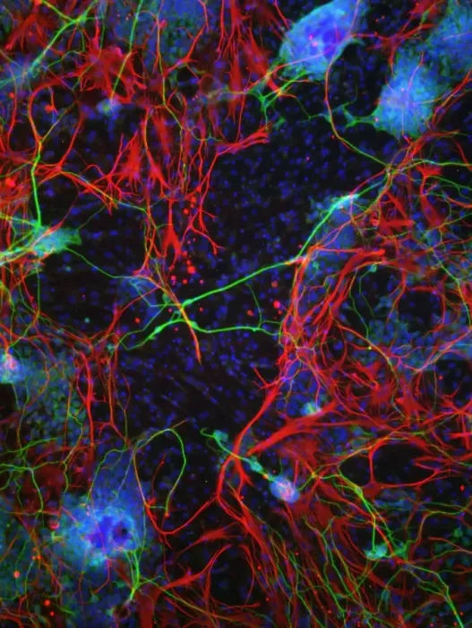 Framed Print : Stem Cell-Derived Nerve Cells Print Framed Print : Stem Cell-Derived Nerve Cells Print
