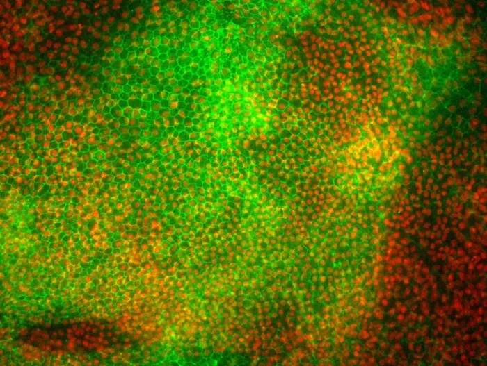 Framed Print : Stem cell-derived retinal cells Print Framed Print : Stem cell-derived retinal cells Print