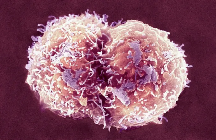 Framed Print : Coloured SEM Print of Stem Cells Framed Print : Coloured SEM Print of Stem Cells