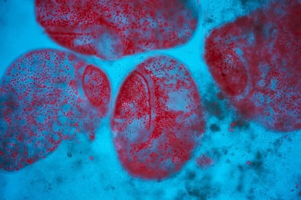 Stentor ciliate protozoa light micrograph