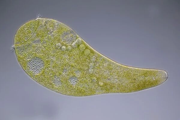 Stentor ciliate protozoan, micrograph