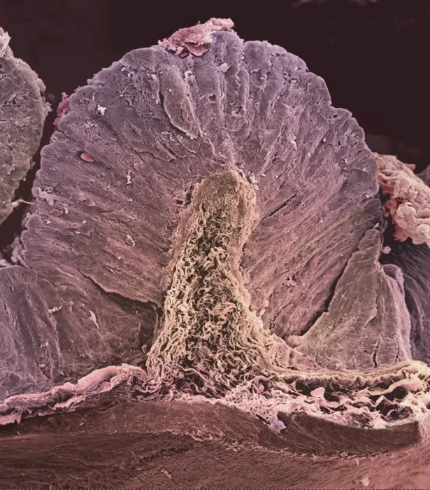 Framed Print : Stomach Wall Print, SEM Framed Print : Stomach Wall Print, SEM