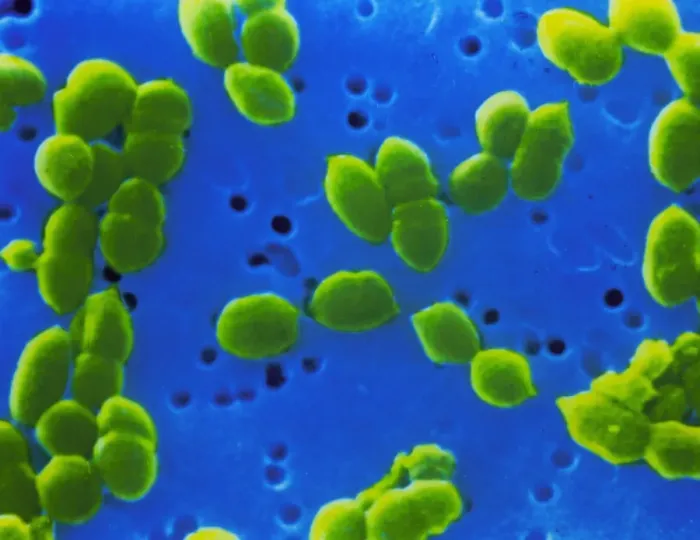 Framed Print : False-colour SEM of Streptococcus pneumoniae bacteria Print Framed Print : False-colour SEM of Streptococcus pneumoniae bacteria Print