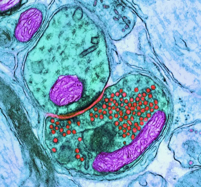 Framed Print : TEM Synapse Print: Nerve Cells and Vesicles Framed Print : TEM Synapse Print: Nerve Cells and Vesicles