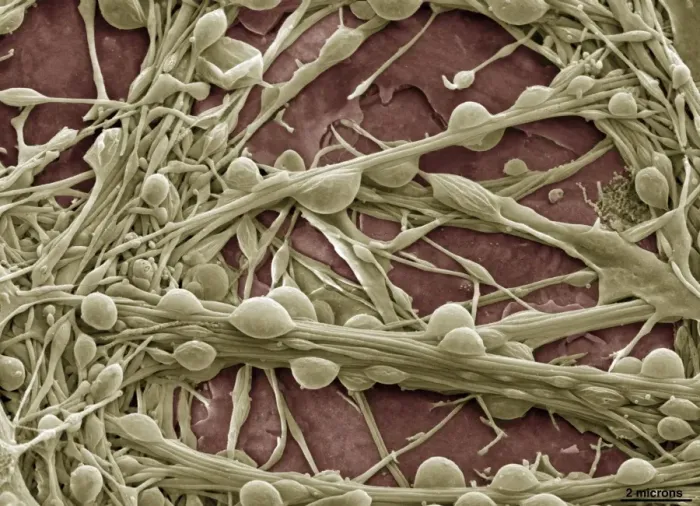 Framed Print : Synapse Nerve Junctions Print, Coloured SEM