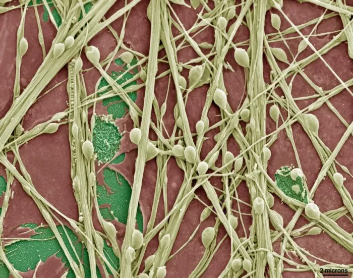 Framed Print : Synapse Nerve Junctions Print, Coloured SEM Image Framed Print : Synapse Nerve Junctions Print, Coloured SEM Image