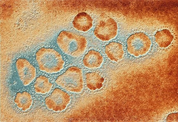 TEM of a cluster of corona viruses F007  /  9890