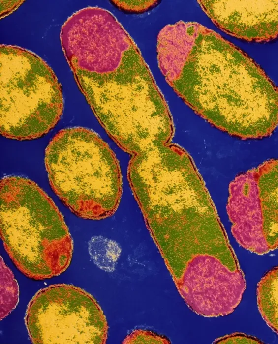 Framed Print : False-colour TEM print of dividing E. coli bacterium Framed Print : False-colour TEM print of dividing E. coli bacterium