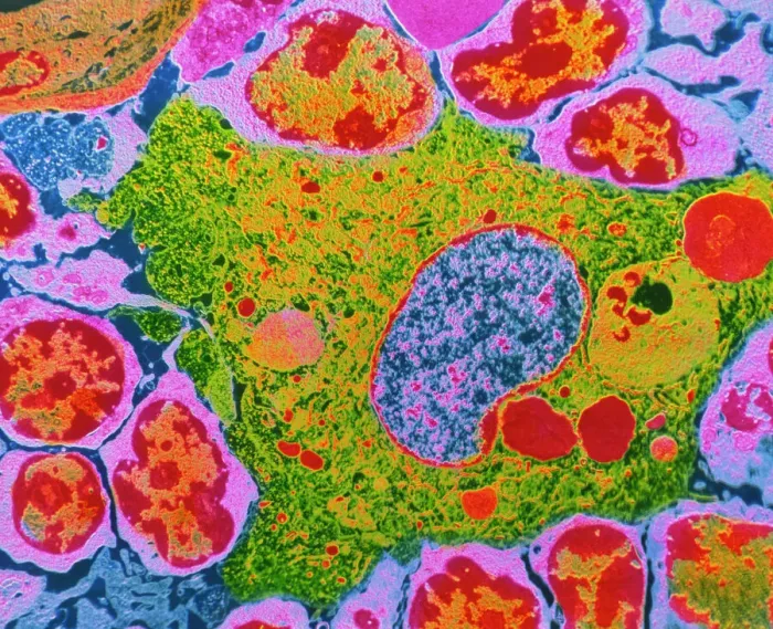 Framed Print : TEM Print of Human Macrophage Cell Framed Print : TEM Print of Human Macrophage Cell