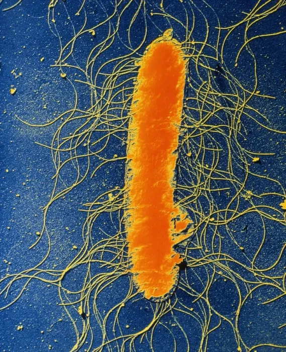 Framed Print : TEM Print of Proteus mirabilis Bacterium Framed Print : TEM Print of Proteus mirabilis Bacterium