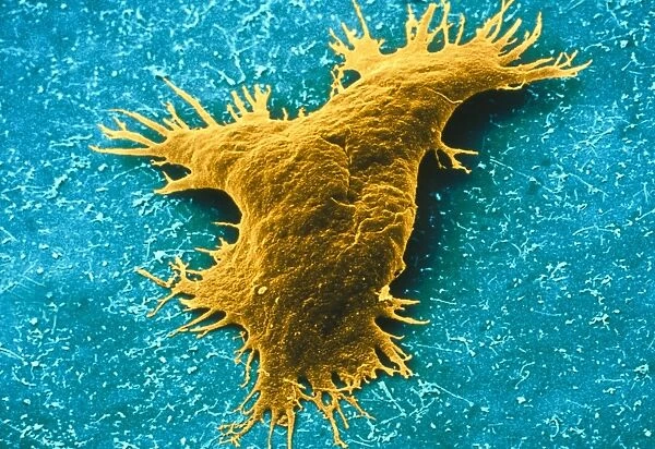 Thalassomyxa australis protozoan