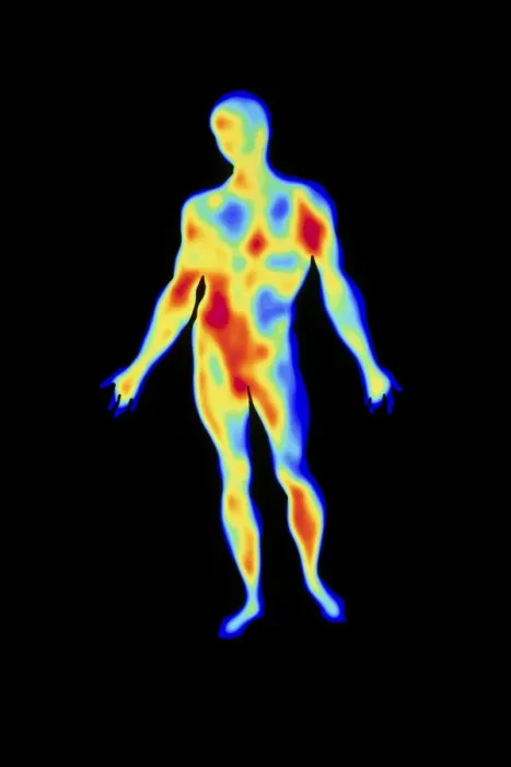 Framed Print : Full-Body Thermogram Print Framed Print : Full-Body Thermogram Print