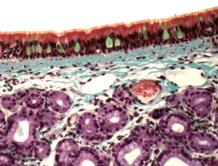 Framed Print : Trachea Print, x200 magnification Framed Print : Trachea Print, x200 magnification