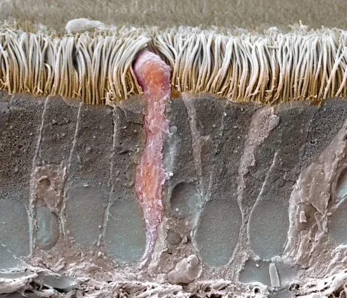 Framed Print : Trachea lining Print, SEM image Framed Print : Trachea lining Print, SEM image