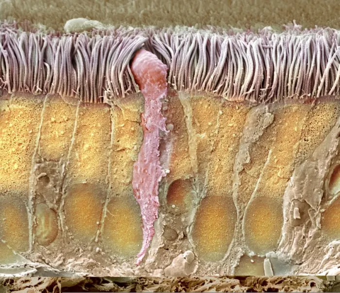 Framed Print : Trachea lining Print, SEM image Framed Print : Trachea lining Print, SEM image