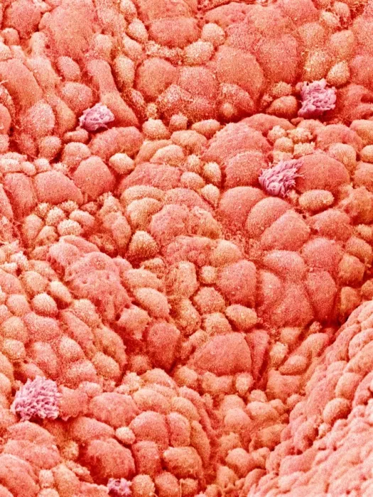 Framed Print : Trachea Lining Print, SEM Image Framed Print : Trachea Lining Print, SEM Image