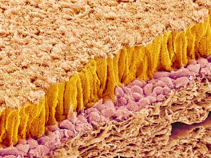 Framed Print : Trachea lining Print, SEM image Framed Print : Trachea lining Print, SEM image