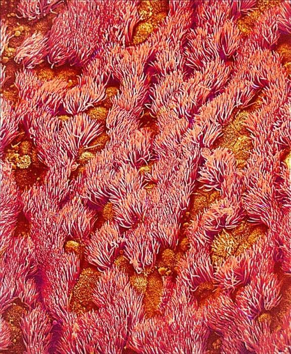 Framed Print : Trachea Print, Coloured SEM Image of Tracheal Lining Framed Print : Trachea Print, Coloured SEM Image of Tracheal Lining