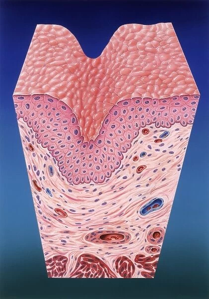 Urinary bladder wall, artwork