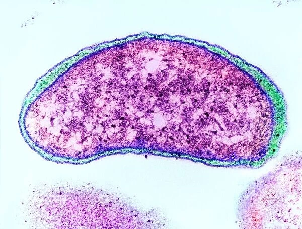 Vibrio cholerae bacterium, TEM