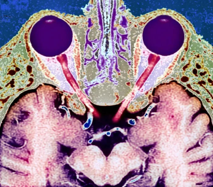 Framed Print : MRI Scan Print of the Head, Axial Section Framed Print : MRI Scan Print of the Head, Axial Section