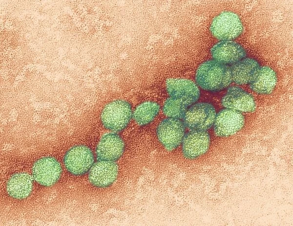 West Nile virus, TEM