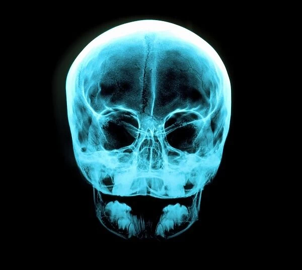 X-ray of human skull