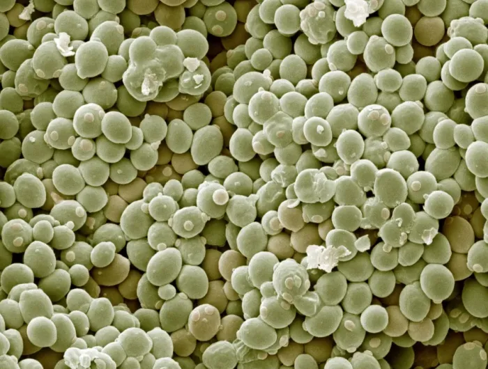 Framed Print : SEM Print of Yeast Cells Framed Print : SEM Print of Yeast Cells