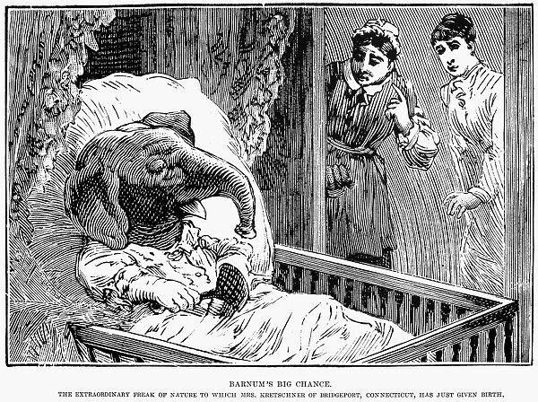 ELEPHANT BOY HOAX, 1887. Barnums big chance. The extraordinary freak of nature to which Mrs