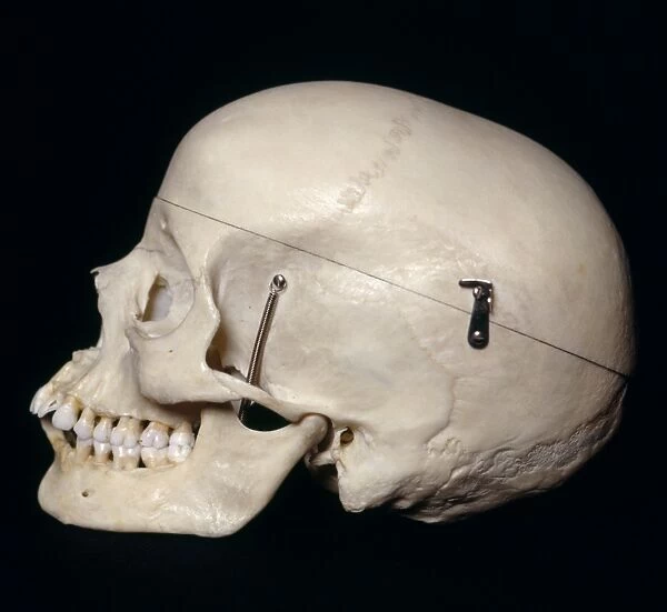 Female skull, side view